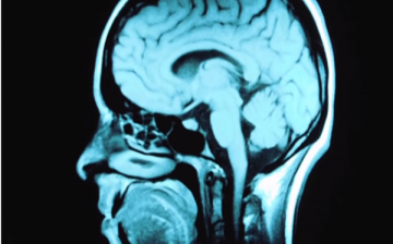 Bioquark Inc. is set to study the brain of clinically dead patients for its latest experiment 