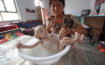 More children with birth defects are born in China.