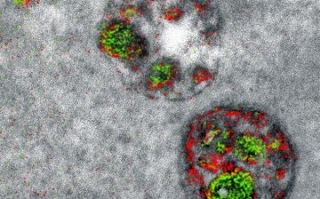 A two-color electron microscopy image of endosomal uptake of peptide proteins.