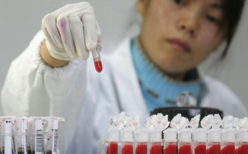 A worker performs a CD4 HIV test at a lab of Shanghai Xuhui District Central Hospital on Dec. 6, 2006, in Shanghai, China. 