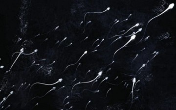 Sperm army of a human male.                  