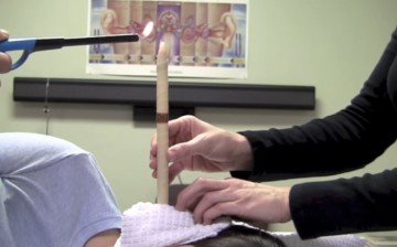 A candle has been lighted and placed right above the ear as part of the alternative earwax removal procedure, known as ear candling. 