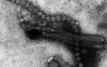 Electron microscope image of the deadly H7N9 virus.                  