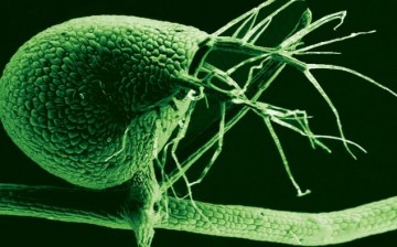 A scanning electron micrograph of the bladder-like trap of Utricularia gibba. The plant uses vacuum pressure to suck in tiny prey at great speed.