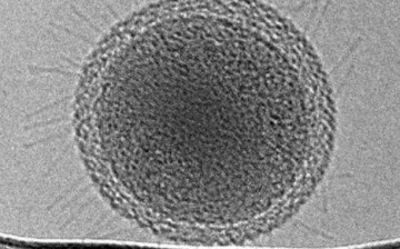 Ultra-small bacterial cell