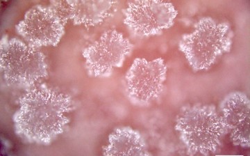 Microscope view of fat bloom on chocolate. 