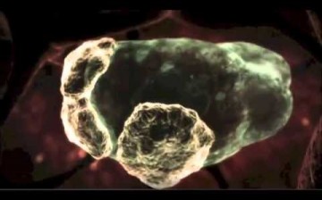 Louisiana Health officials report that the brain-eating amoeba called naegleria fowleri amoeba has been found in the state's water supply. 