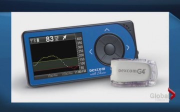 DexCom G4 glucose monitor