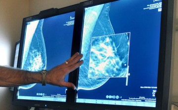 Mammogram