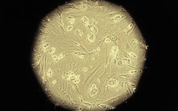 Embryonic stem cells are pictured through a microscope viewfinder in a laboratory. 