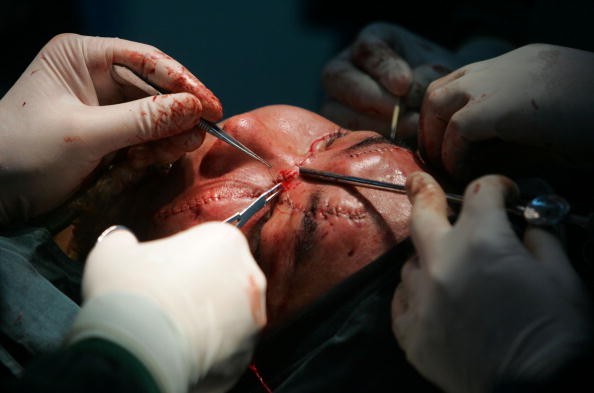 China's First Facial Transplant Patient Receives Second Step 0peration