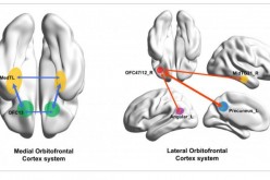The human medial (reward-related, OFC13) and lateral (non-reward-related, OFC47/12) orbitofrontal cortex networks that show different functional connectivity in patients with depression.