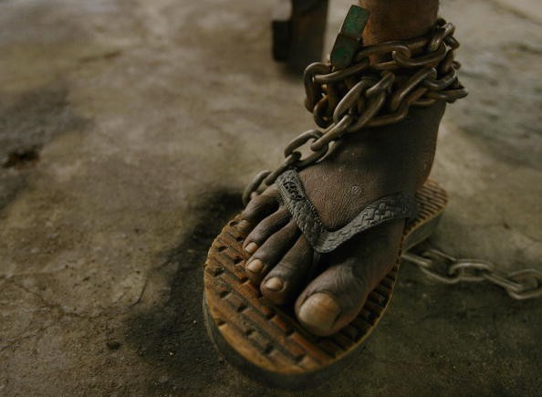 A patient's foot is chained at a Liberian mental facility Aug. 28, 2003 in Monrovia, Liberia. 