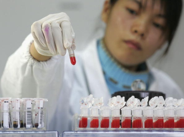 A worker performs a CD4 HIV test at a lab of Shanghai Xuhui District Central Hospital on Dec. 6, 2006, in Shanghai, China. 