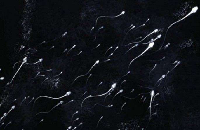Sperm army of a human male.                  