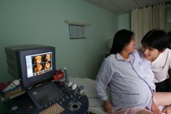 Mother who is  32 weeks pregnant saw the dynamic 3D ultrasound image of her quadruplets at Tongji Hospital