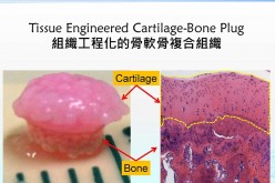 Tissue Engineered Cartilage-Bone plug