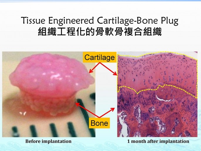 Tissue Engineered Cartilage-Bone plug
