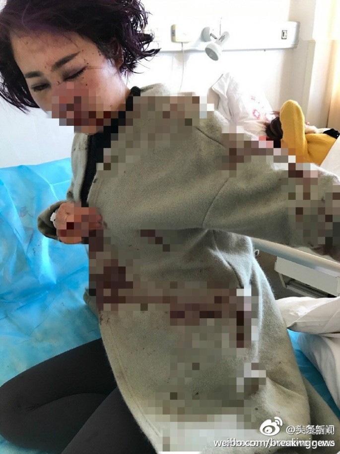 Lijiang Attack Victim