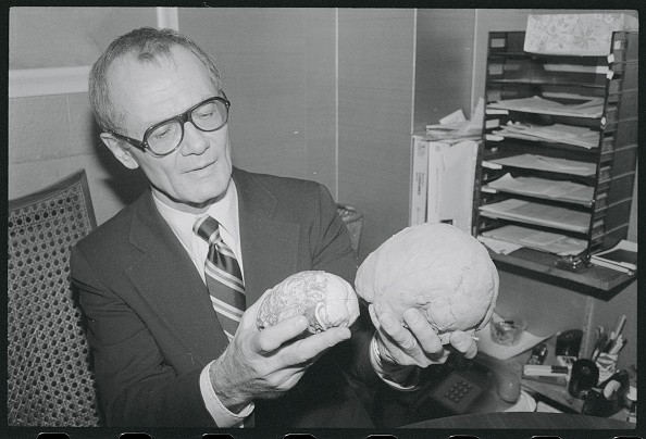 Dr. Robert Jastrow holds models of man's brain, showing its smaller size of 2 million years ago and the modern brain.