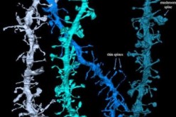 3D reconstructions of electron microscope images of tree branch-like dendrites.          