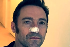 Hugh Jackman took a snapshot of his recently treated skin cancer.