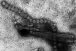 Electron microscope image of the deadly H7N9 virus.                  