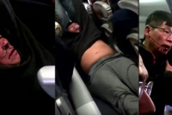 Dr. David Dao suffered this ordeal when airport security officers forced him, upon orders from United Airlines, to leave its Kentucky-bound plane on April 9. The flight was overbooked.