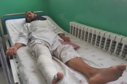 A wounded worker from Halo Trust, a de-mining organisation, receives treatment at a hospital in Baghlan province, Afghanistan 