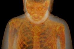 An x-ray shows the mummified remains of Liuquan, a Buddha