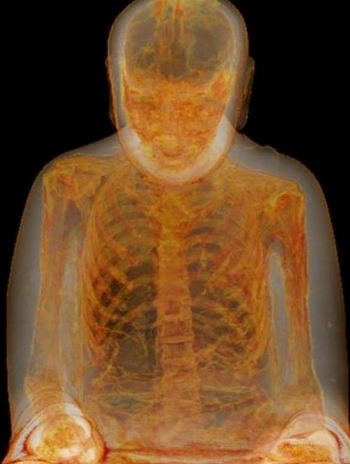 An x-ray shows the mummified remains of Liuquan, a Buddha