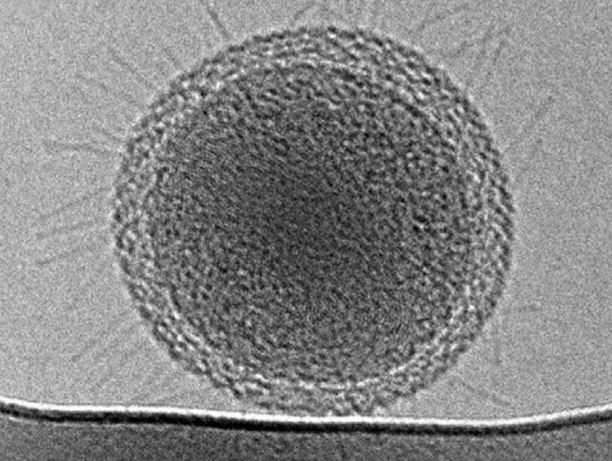 Ultra-small bacterial cell