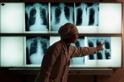 Tuberculosis still remains as China's top public health threat among various infectious diseases.