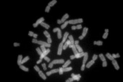 Human chromosomes