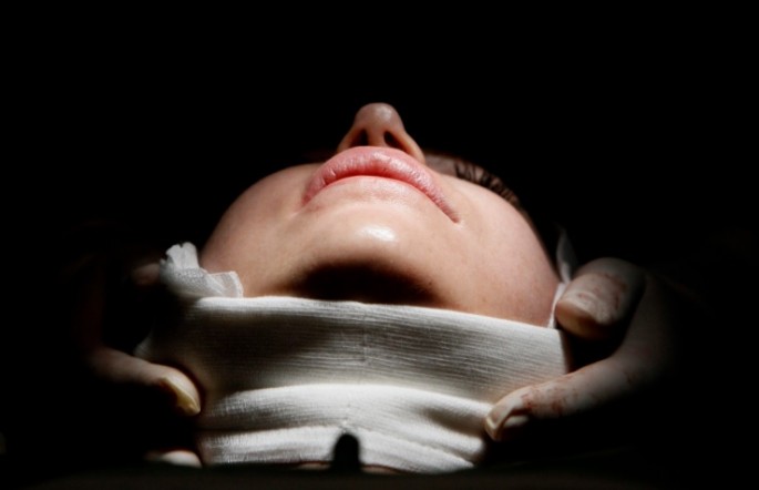 A woman lies on an operating table during a facelift surgery 