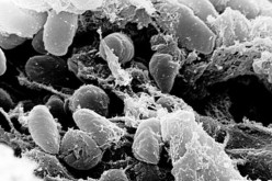 The Y. pestis bacteria that causes pneumonic plague.