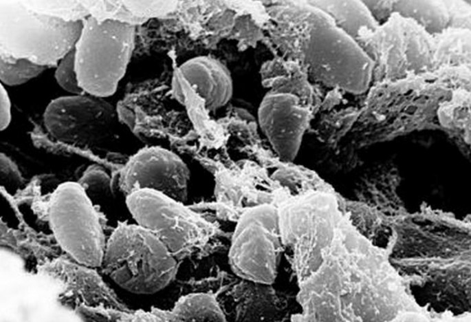 The Y. pestis bacteria that causes pneumonic plague.