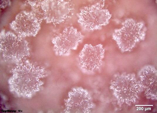 Microscope view of fat bloom on chocolate. 