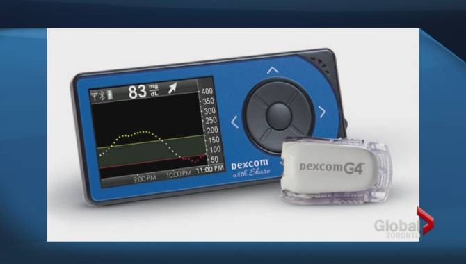 DexCom G4 glucose monitor