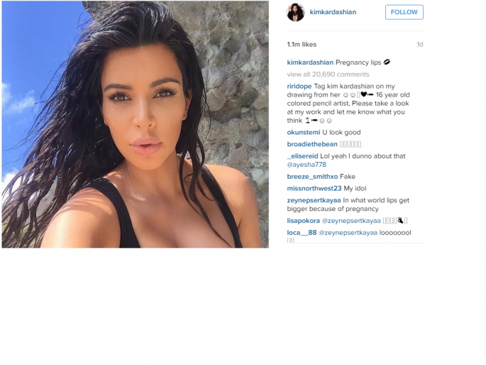 Kim Kardashian's "Pregnancy Lips" Spark Plastic Surgery Debate