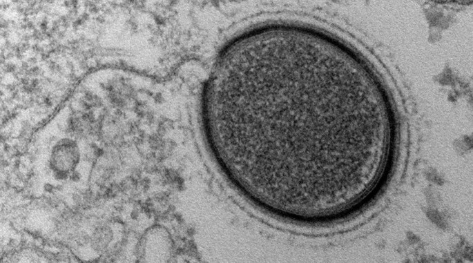 The Mollivirus sibericum will be revived by scientists, dating back to the Ice Age.