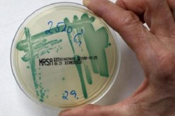 A bacterial strain is seen in a bacterial culture at a microbiology lab in Berlin.