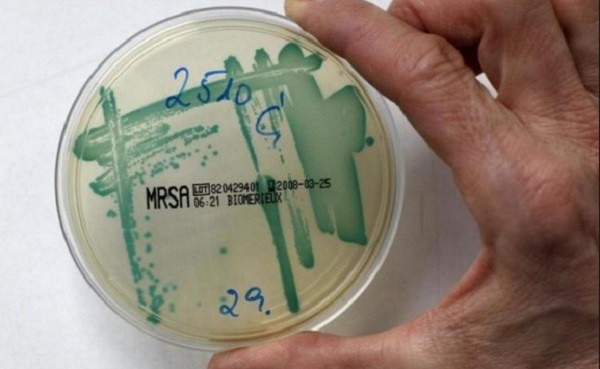 A bacterial strain is seen in a bacterial culture at a microbiology lab in Berlin.