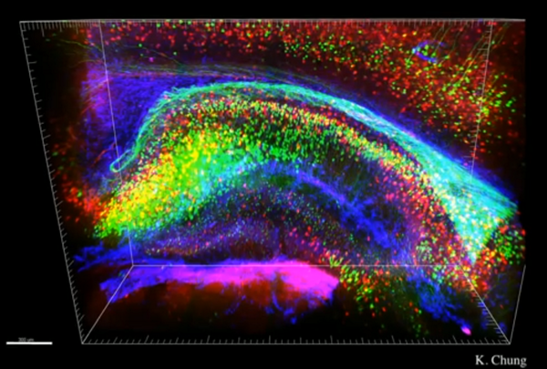 Neural Portrait of Human Brain 