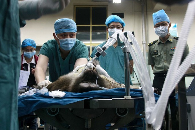 Liver Transplant From A Transgenic Pig To A Macaque