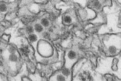 A transmission electron micrograph (TEM) shows the Zika virus, in an undated photo provided by the Centers for Disease Control and Prevention in Atlanta, Georgia. 