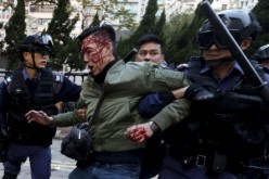 Hong Kong Street Violence
