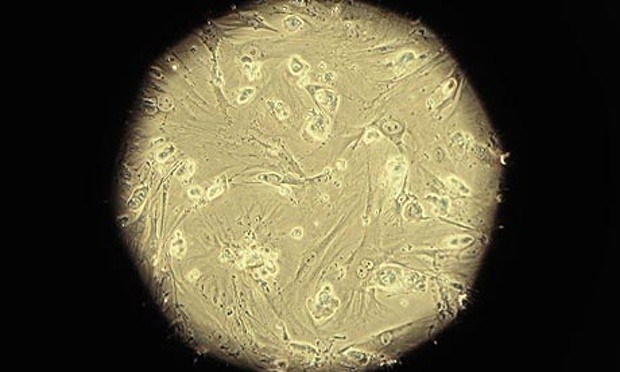 Embryonic stem cells are pictured through a microscope viewfinder in a laboratory. 