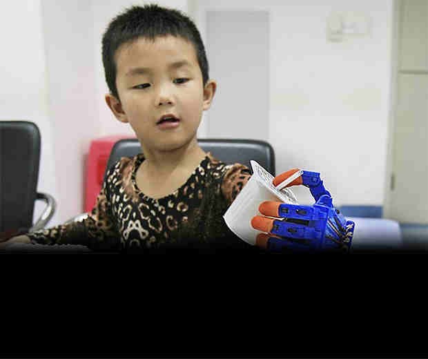Previously, Chinese doctors used 3D printing technology to provide a boy in Wuhan with a 3D-printed prosthetic hand.
