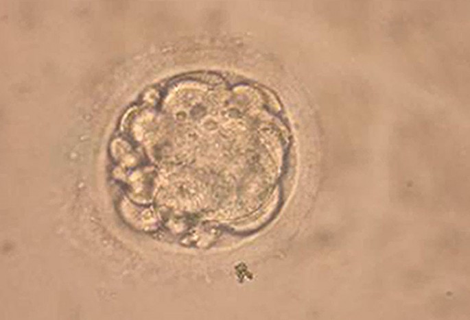 Chinese scientists successfully modified non-viable embryos to make them HIV-resistant.